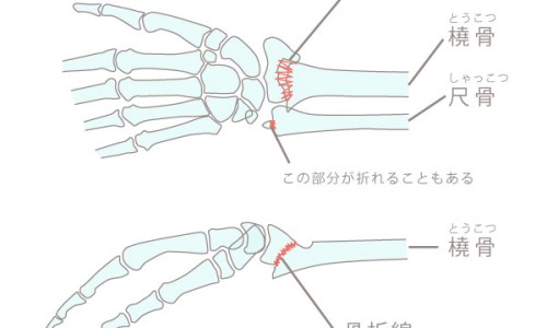 野猪肉和家猪的区别-野生猪肉与圈养猪肉的区别网- 野猪肉和普通猪肉哪个贵知识,分享圈养野猪肉多少一斤